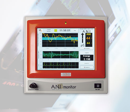 ANI Monitor 持續疼痛監測儀